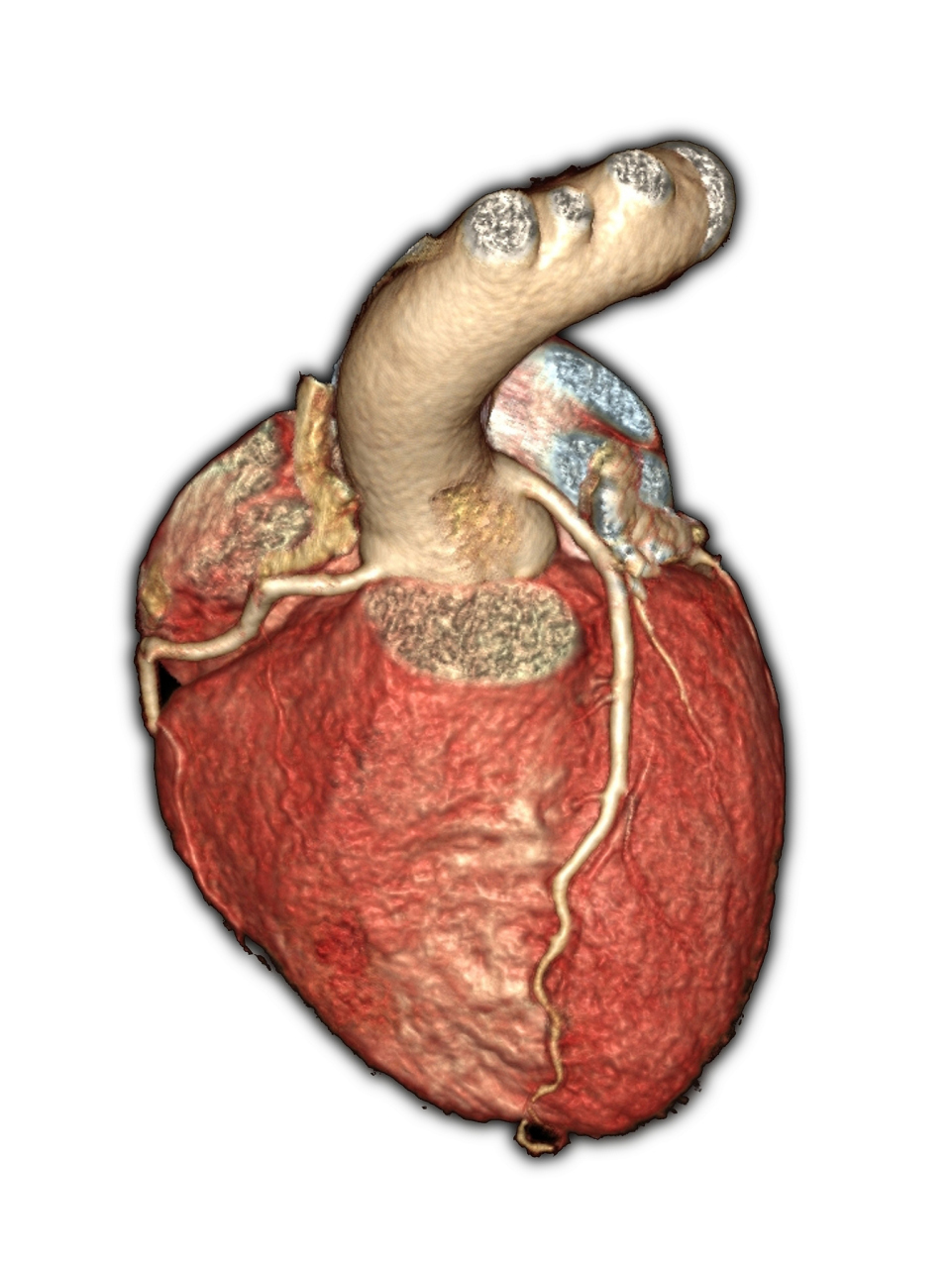 引起脾脏肿大的原因有很多,包括感染性疾病,血吸虫病,消化系统疾病