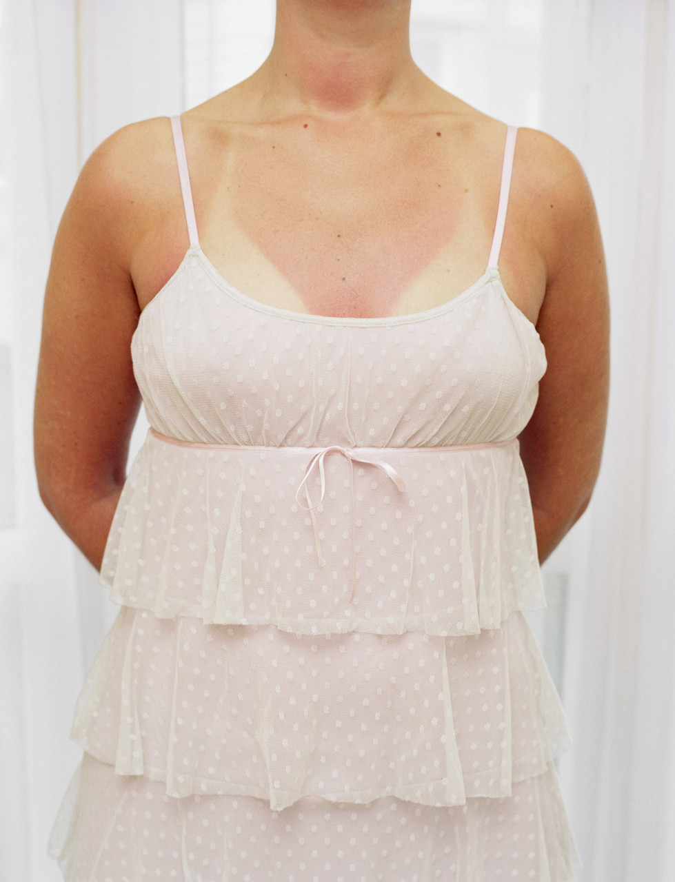 减肥后胸部松弛下垂怎么办 #医美科普挑战赛#   减肥后胸部松弛下垂是