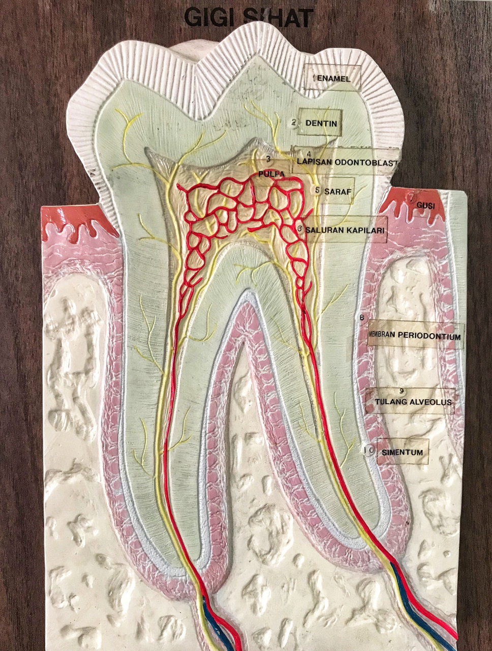 牙内吸收# 牙内吸收也被称为髓腔内吸收,即髓腔