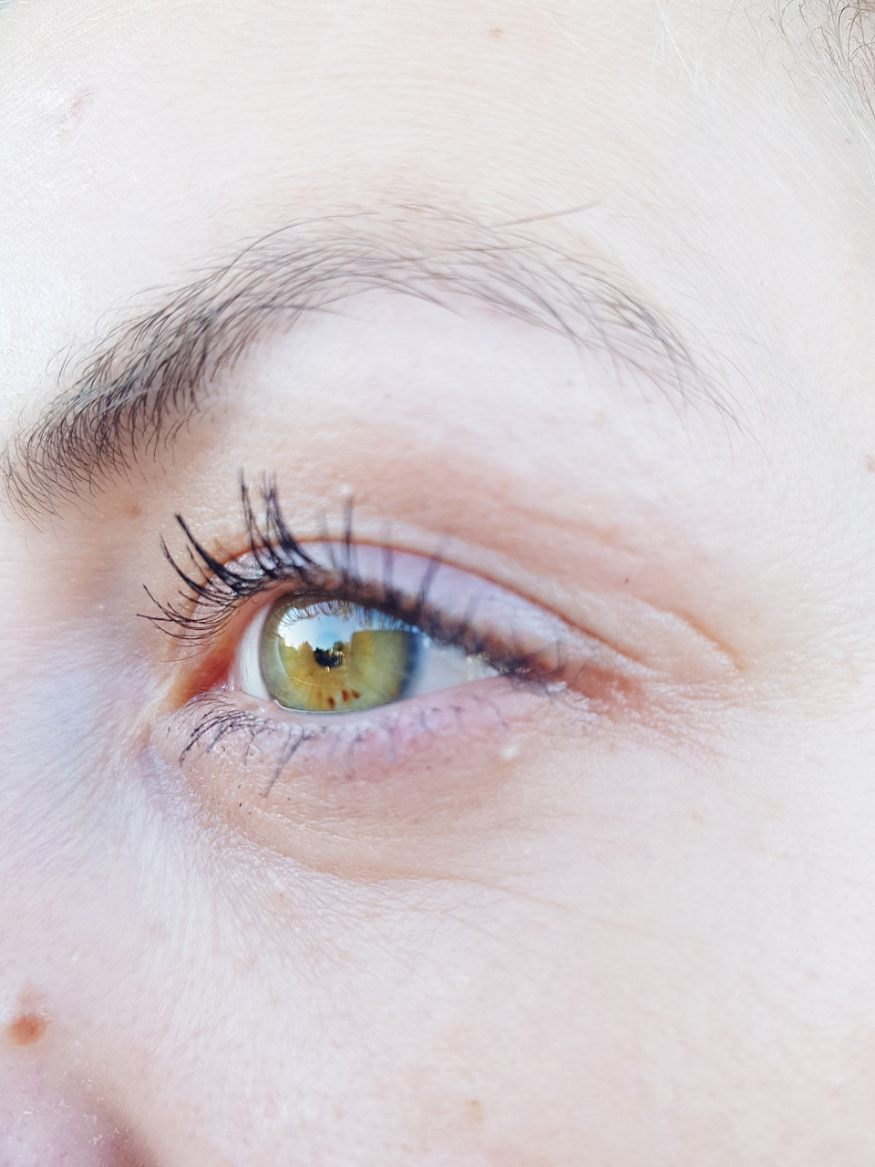 眼角皮肤变白了是什么情况    眼角皮肤变白了是指眼角周围的皮 