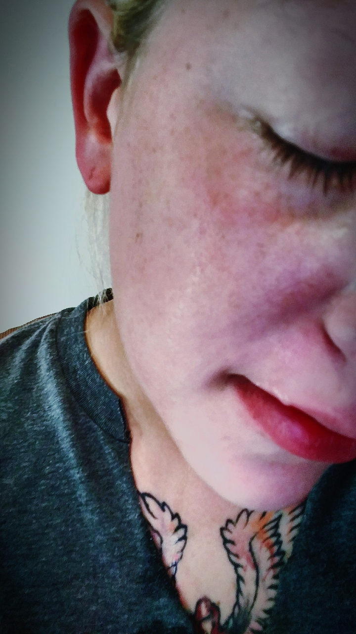 大红脸怎么治疗  大红脸是指面部潮红,发红或泛红的症状,可能是由多种