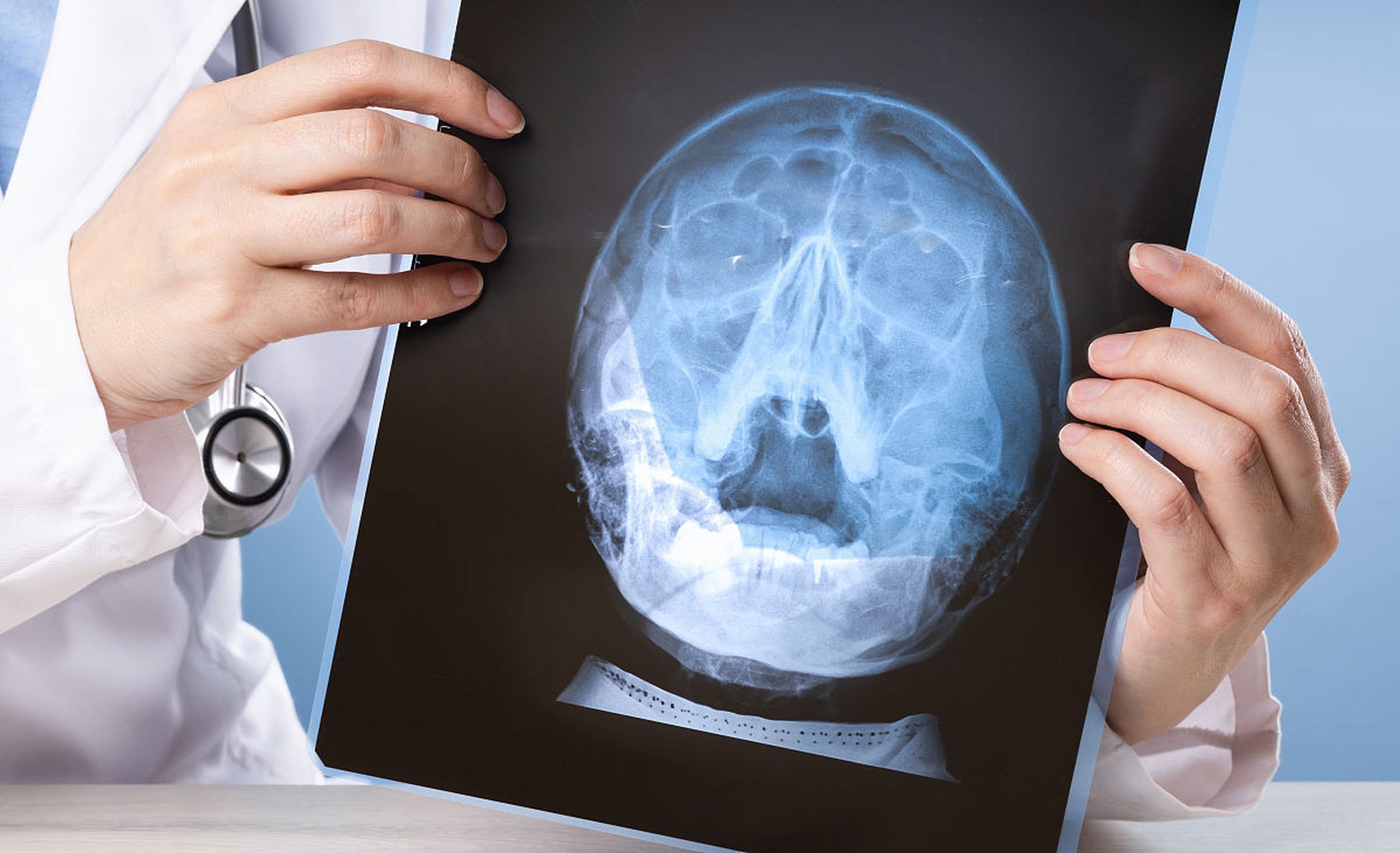 医学影像学要学哪些知识 医学影像学专业毕业生可以从事医学影像诊断,