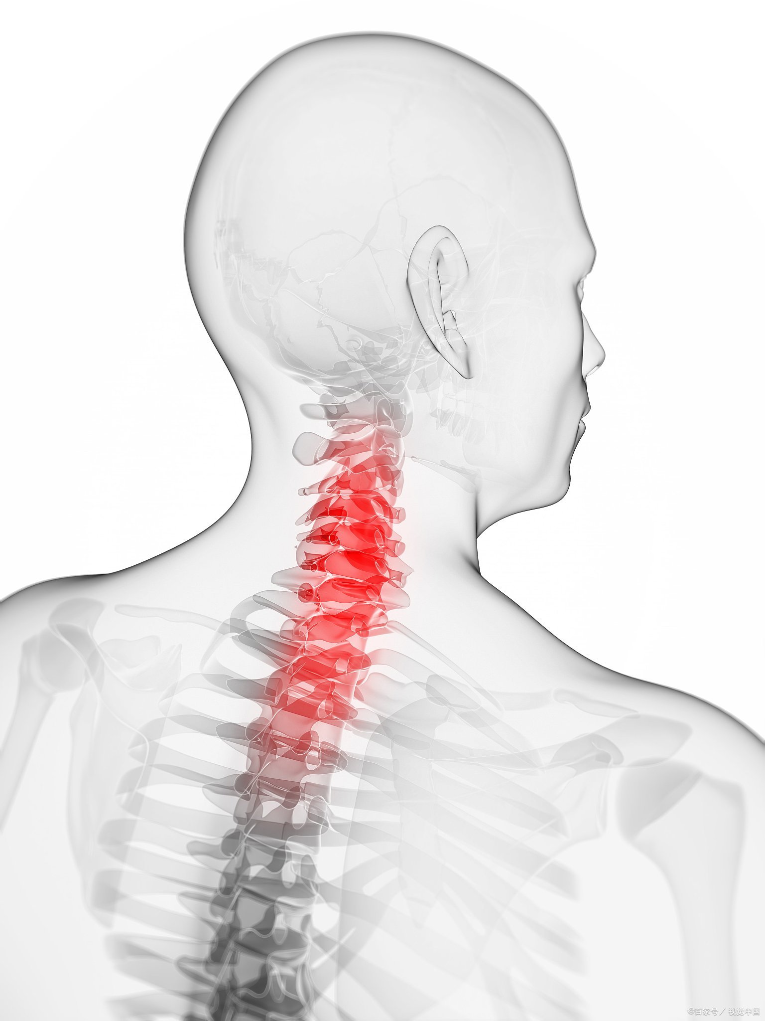右侧颈椎痛到脖子像被卡住,连转头都成难题?别硬扛!