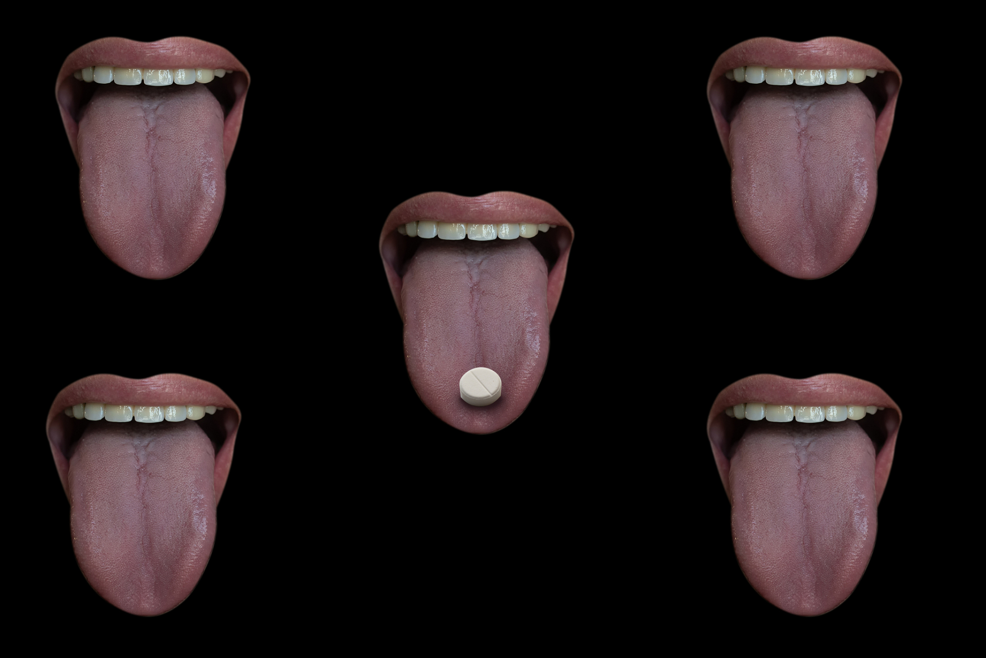 是一种中医诊断方法,通过观察舌头的颜色,形状,舌苔等特征来判断病情