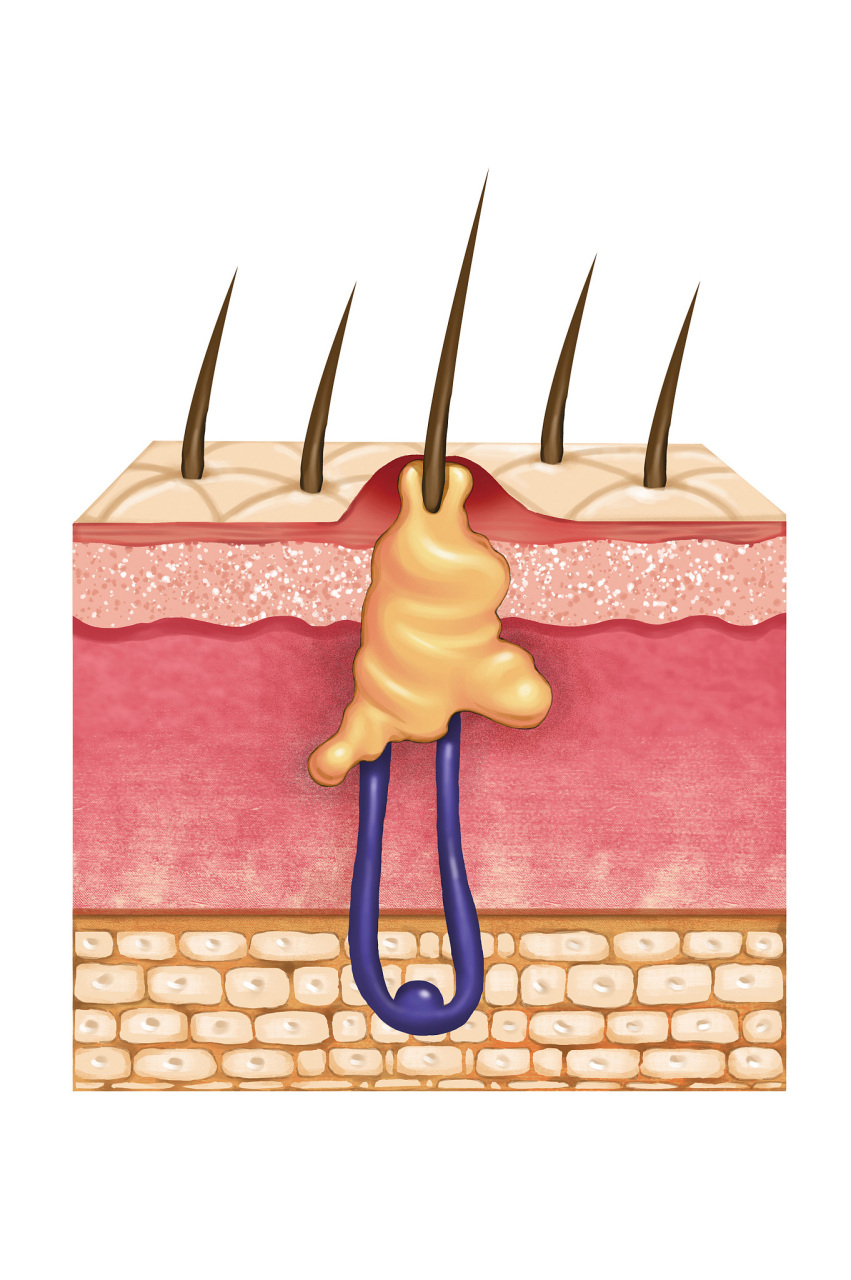 毛囊检测能查出脱发原因吗 #毛囊检测# #医美科普挑战赛#   毛囊检测