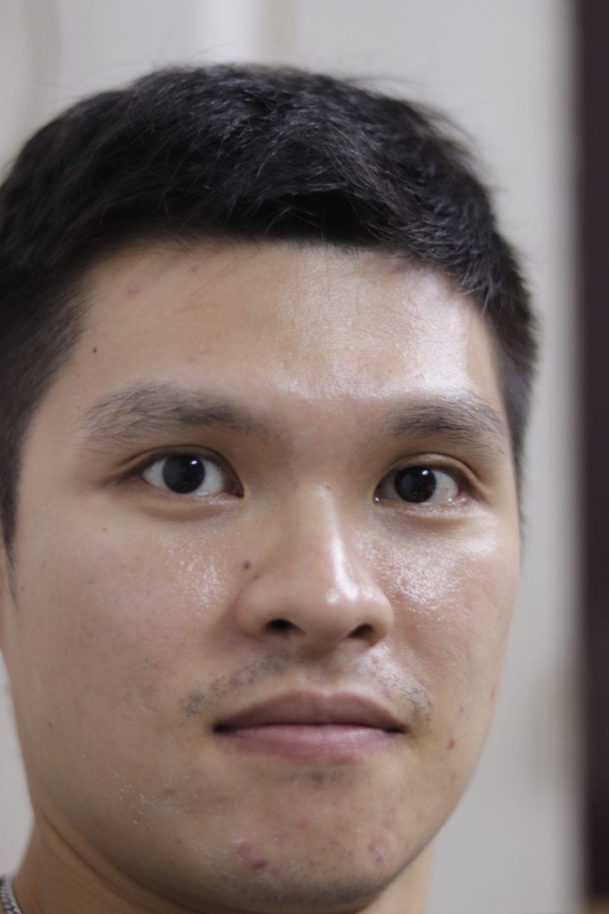 明明很多中国人皮肤并不黄,为什么会被称为黄种人?