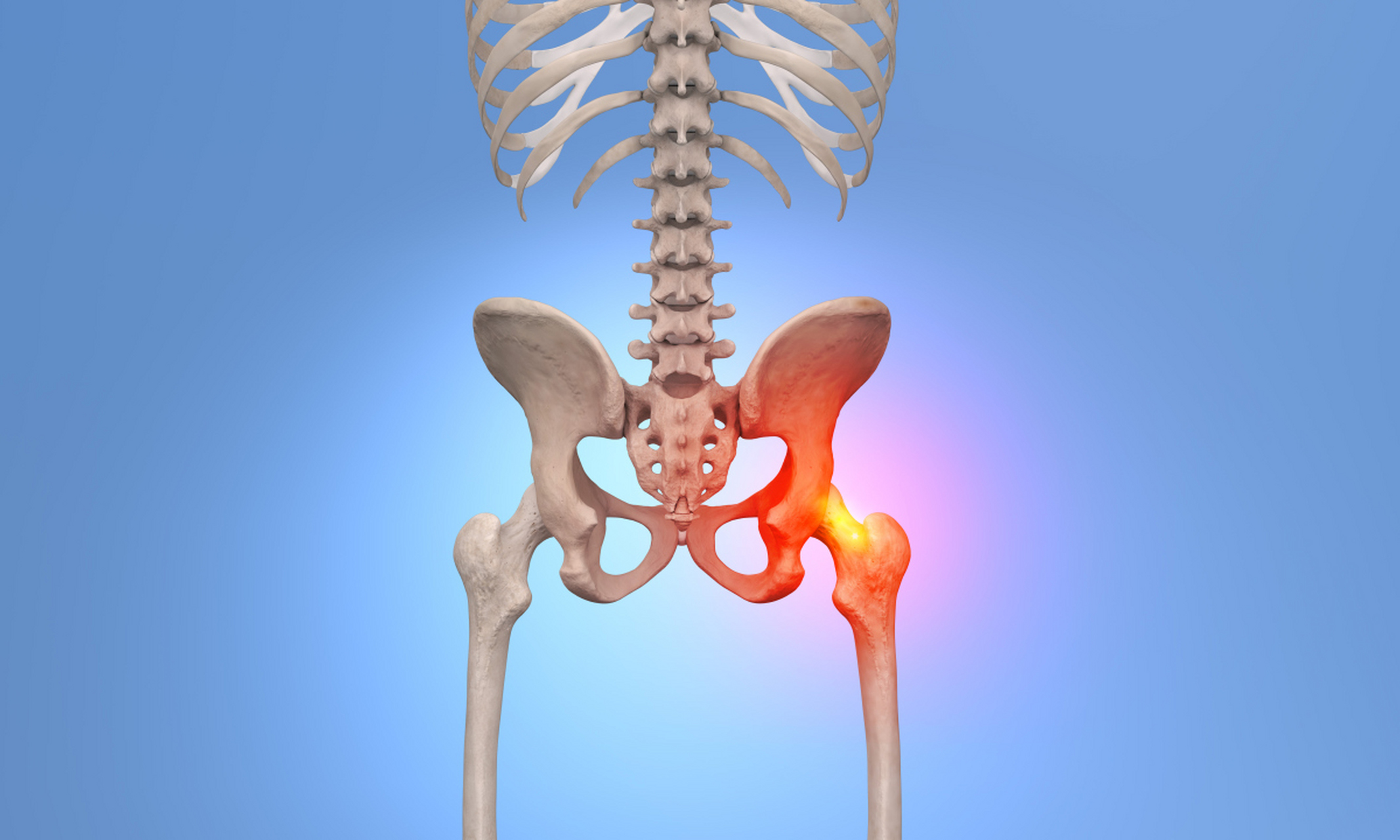 髋关节积液会表现出髋部肿胀,疼痛,僵硬和活动受限等症状.