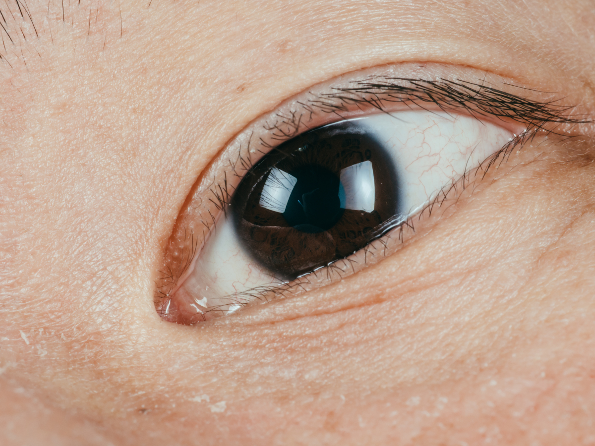 如何判断自己双眼皮是否需要做其他项目?