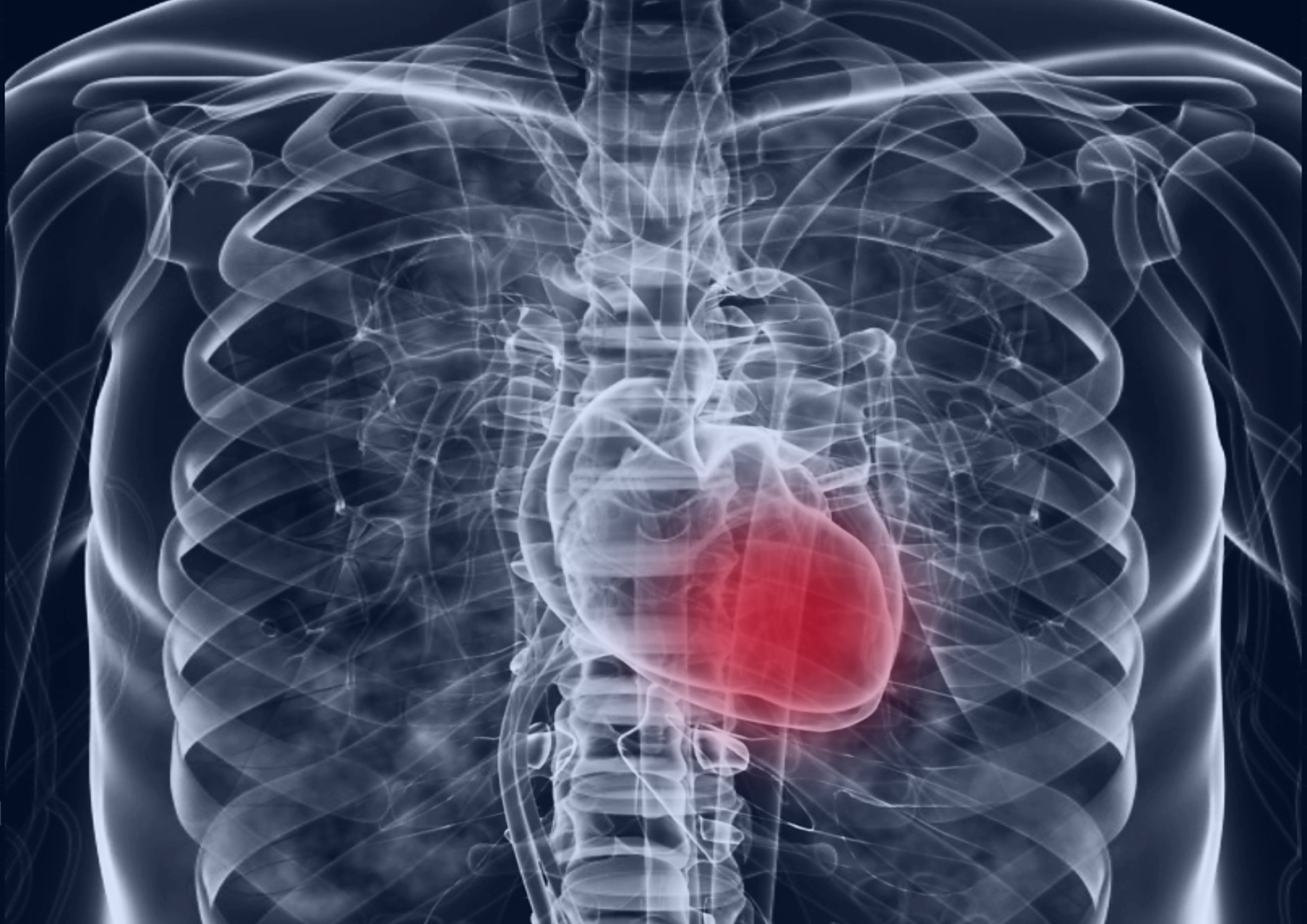 肋间神经因为各种原因(病毒,创伤等)出现的炎症反应,就是肋间神经 