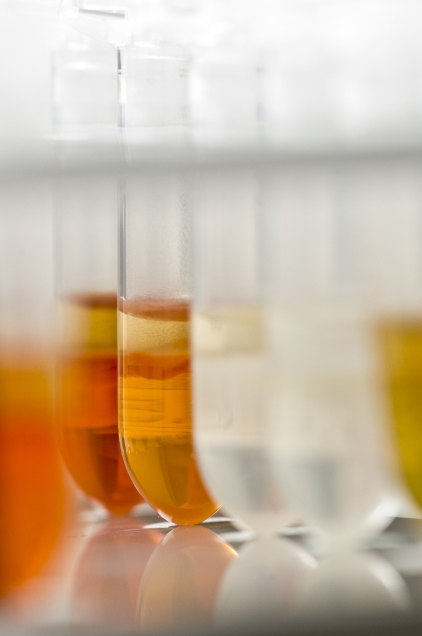 导致尿液发黄的原因有哪些?尿黄味道重是怎么回事?