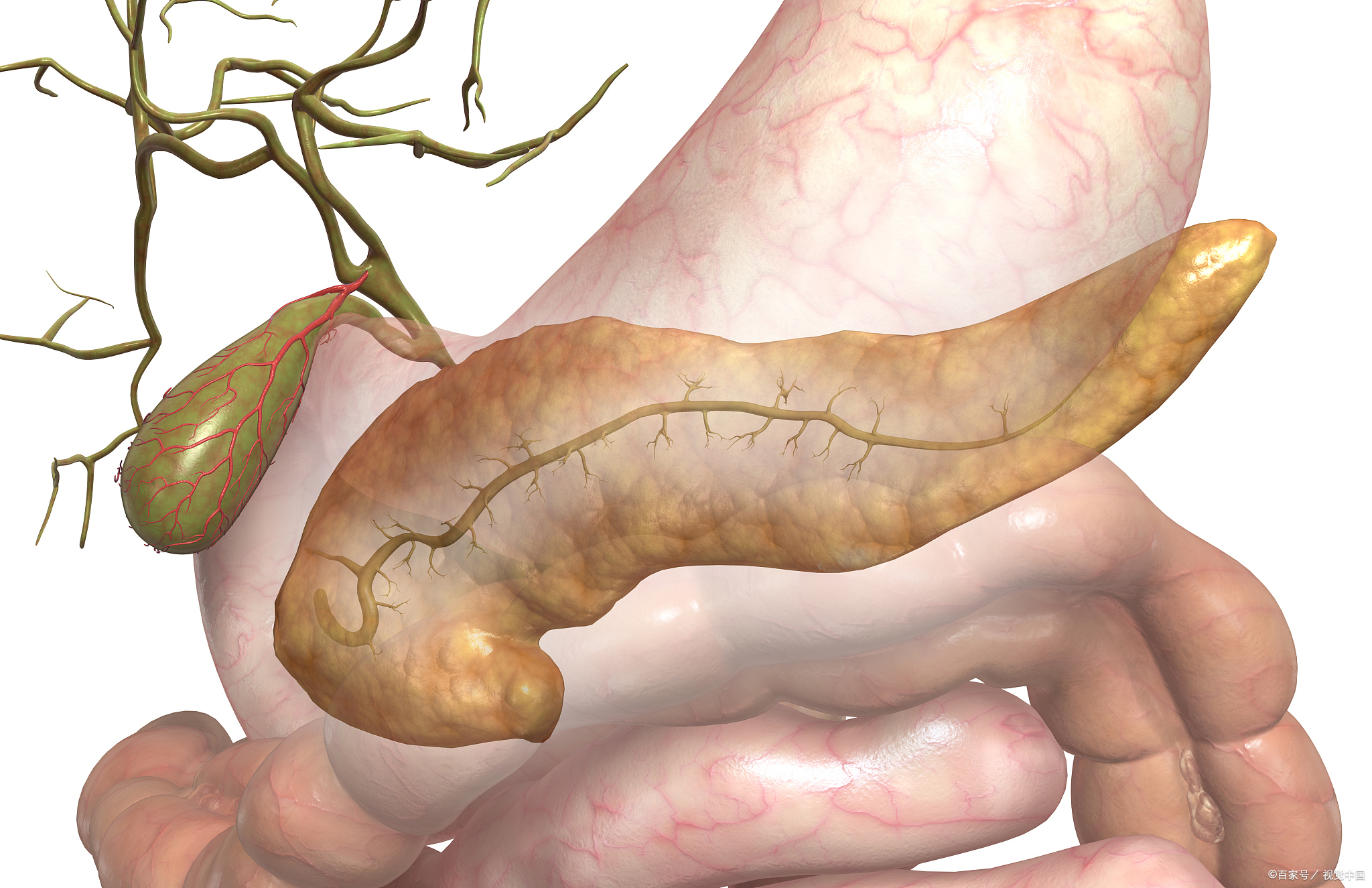 急性胰腺炎不能忽视,重则危及生命