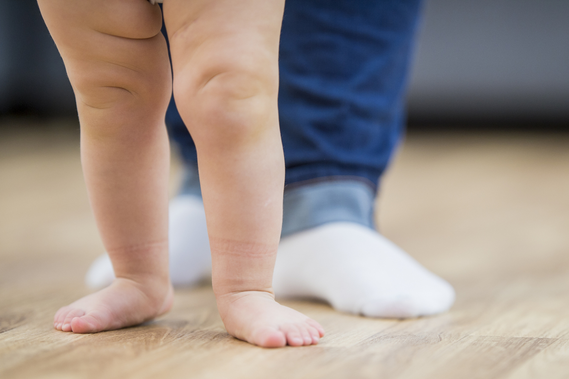 ⭐️很多宝宝出生后,家长会发现孩子的腿纹不对称,其实小腿纹不一