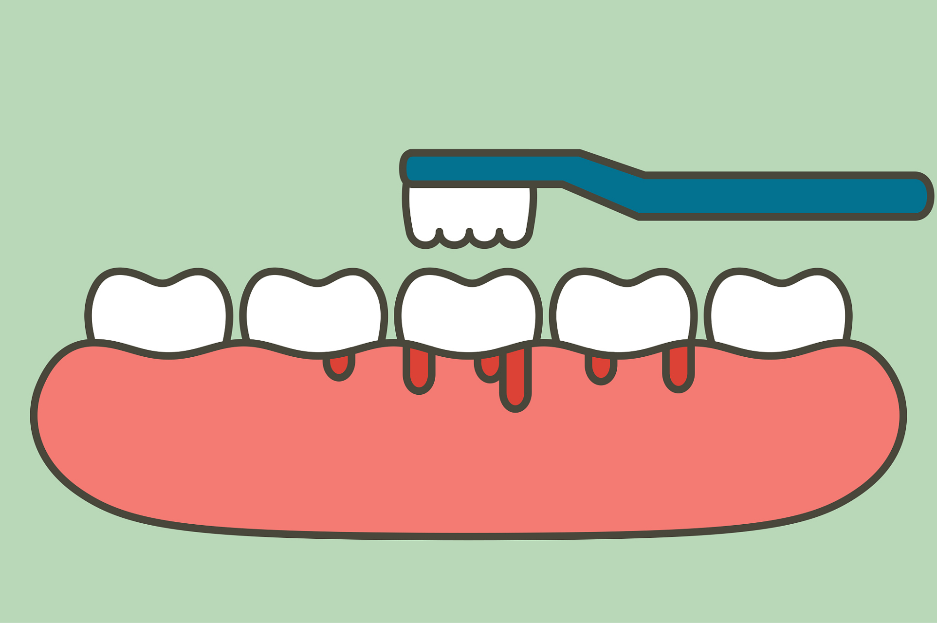 维生素c可以有效预防坏血病,这是因为坏血病的发生主要是因为人体缺乏