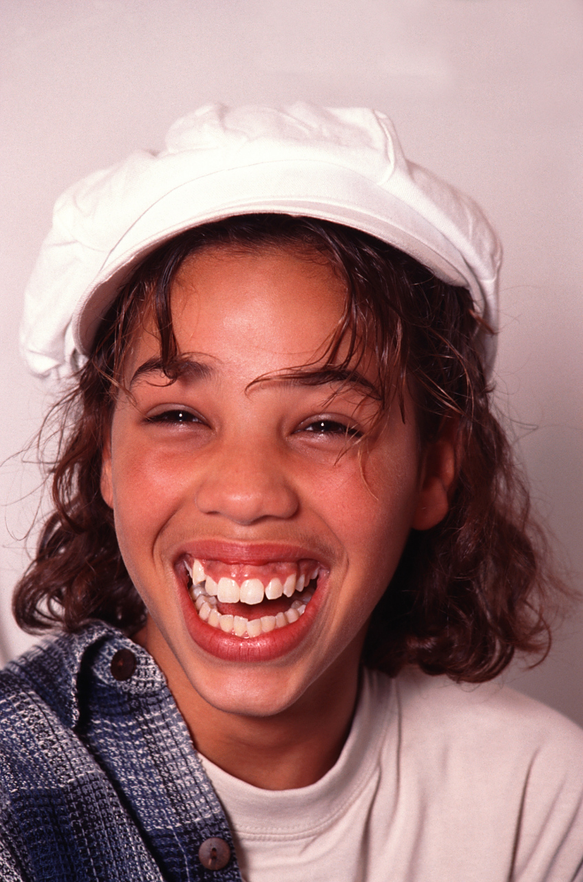 女孩地包天多大年龄矫正最好?