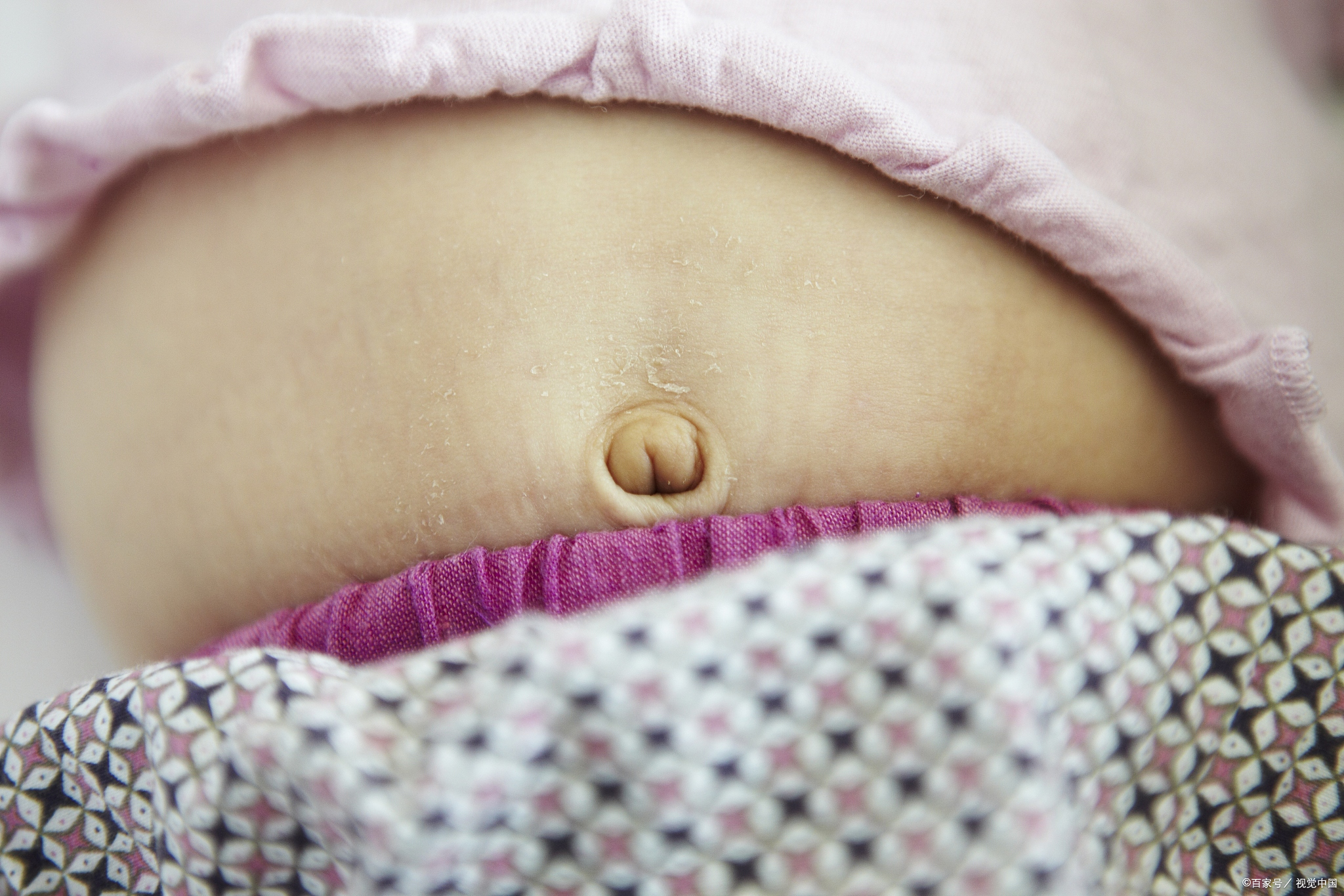 宝宝过敏性肠炎症状是什么