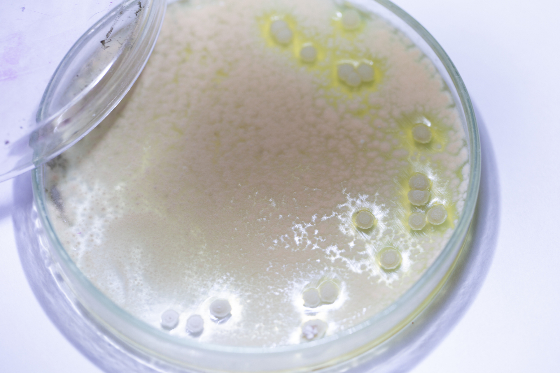 米酵菌酸中毒病死率超50%. #米酵菌酸中毒病死率超五成