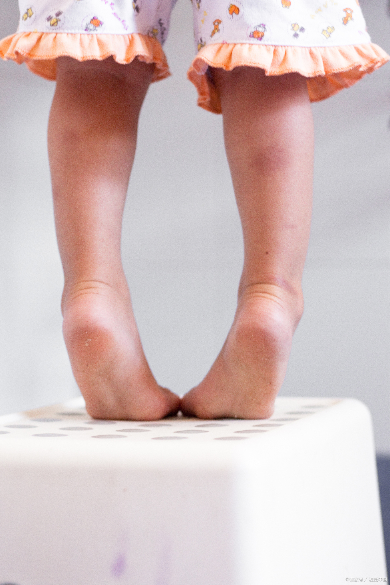 错过黄金期当心娃腿型