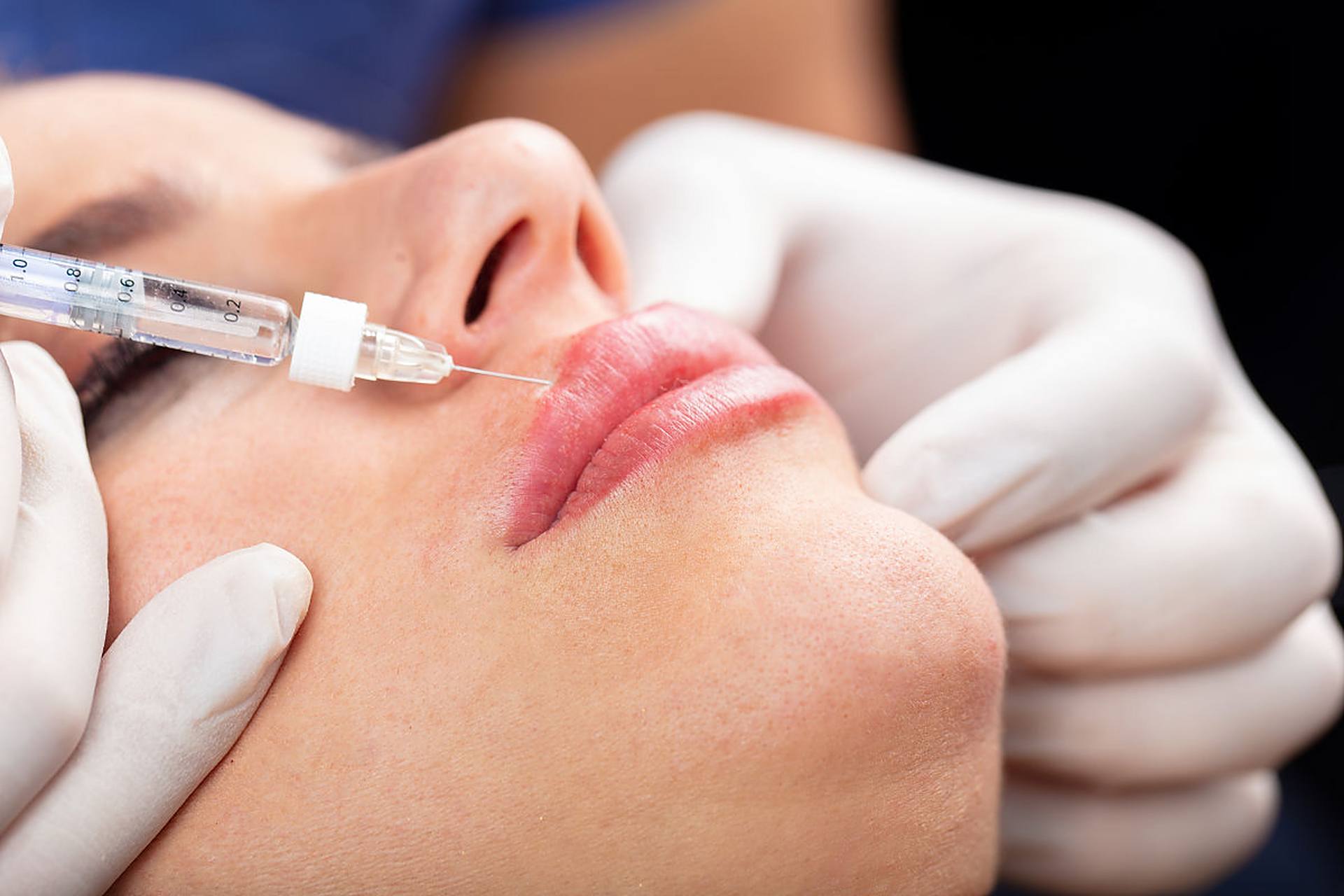 很多患者朋友们都问我手打和机打水光针哪种注射方式更好.