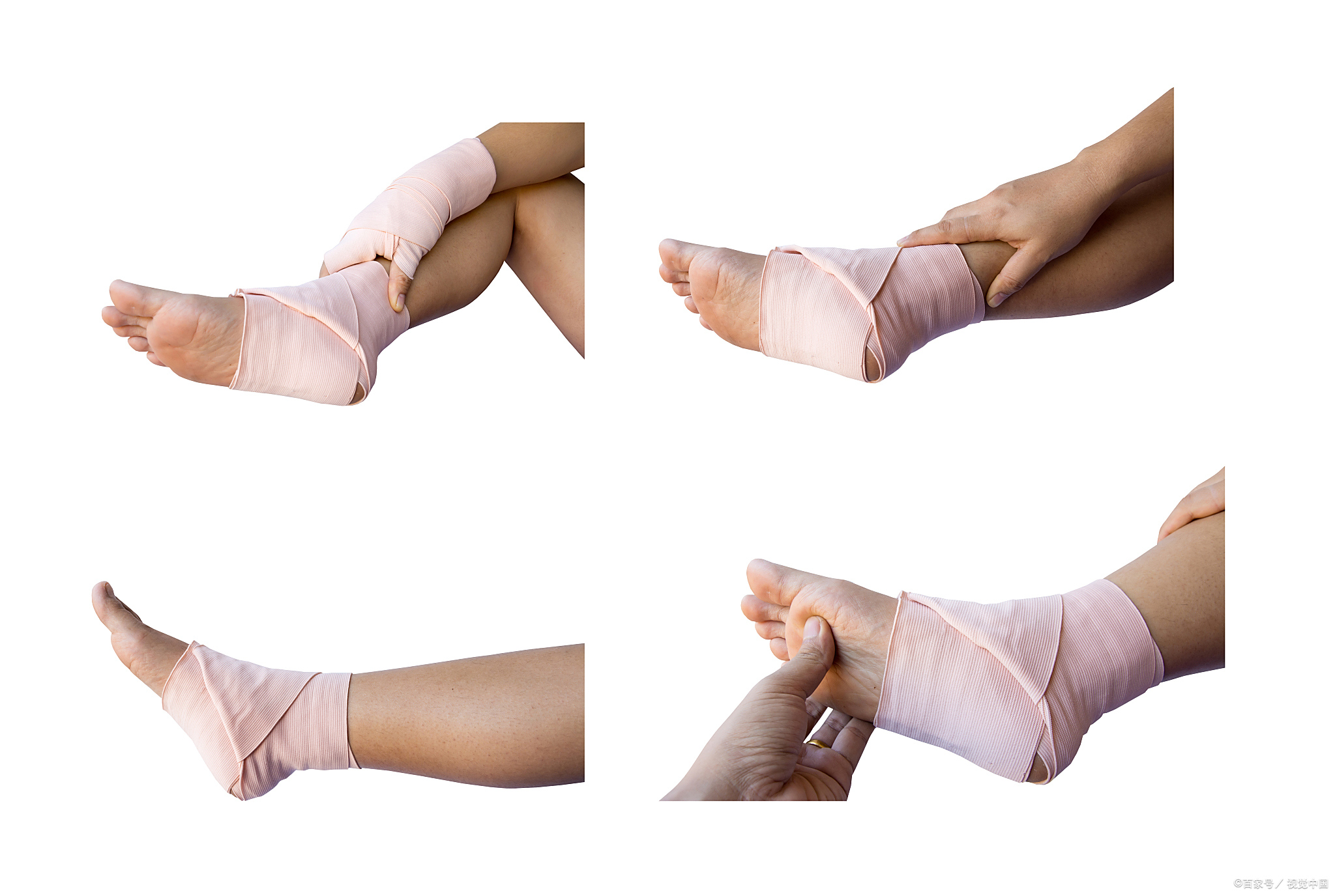 关节变形了有哪些治疗方法