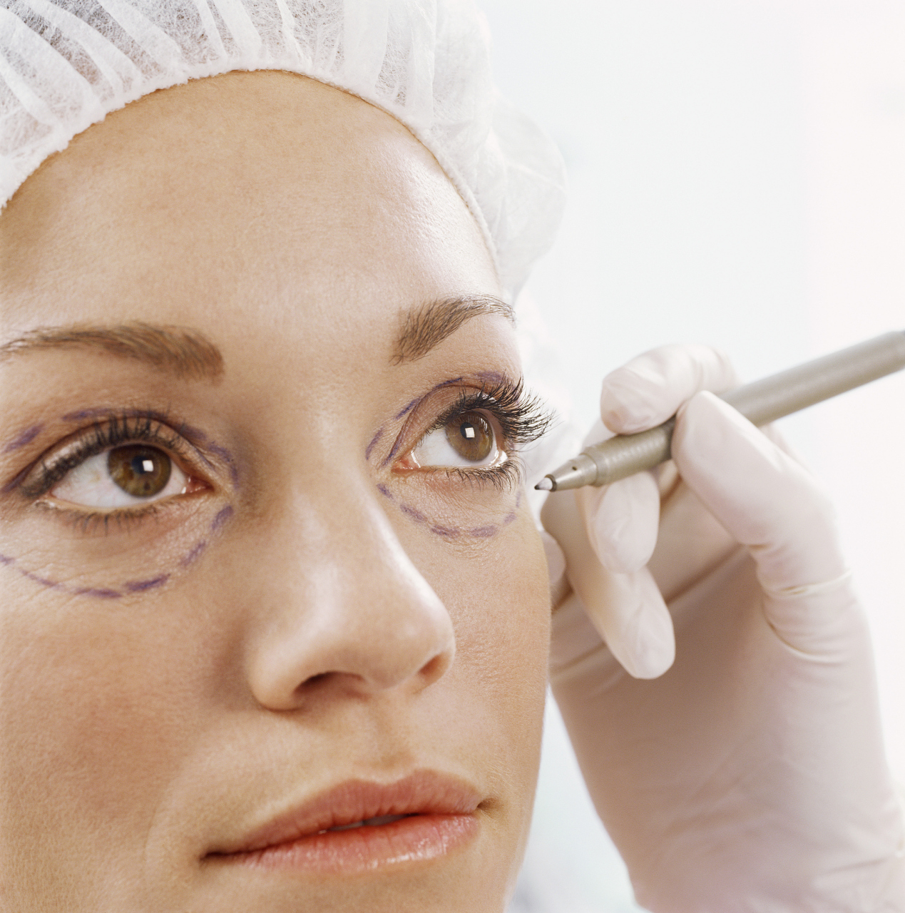 瘦脸抽脂大概要多少钱  瘦脸抽脂是一种常见的面部塑形手术,通过抽取