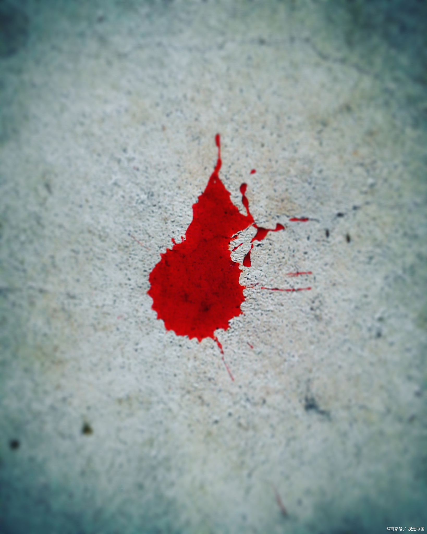 大家好,今天我们来聊聊一个很多使用曼月乐环的女性都关心的问题:出血