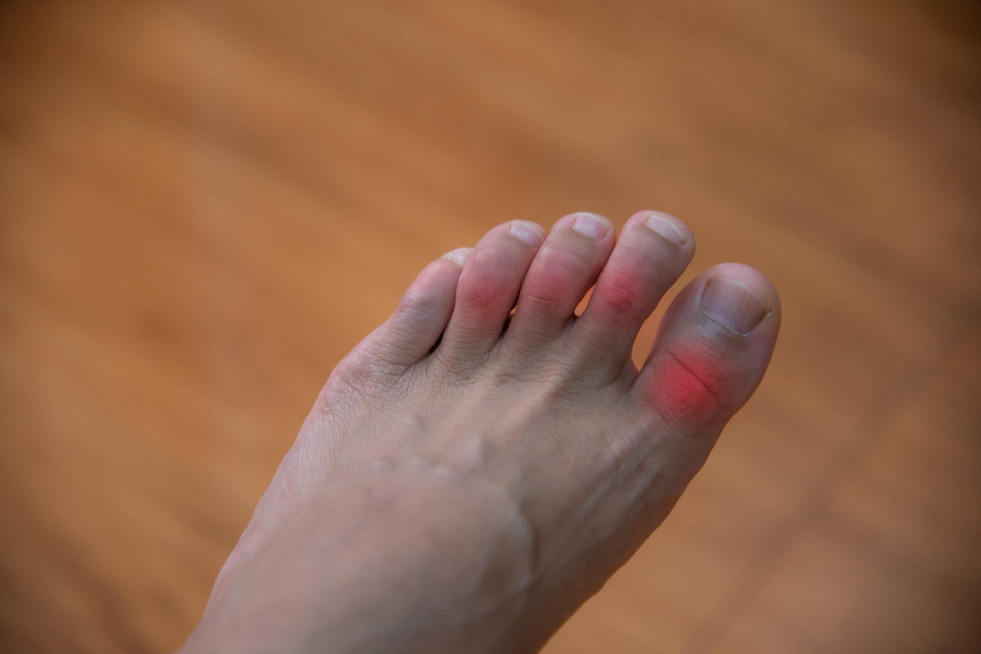 脚拇指疼痛是一个常见的征兆,可能表明身体出现某些问题