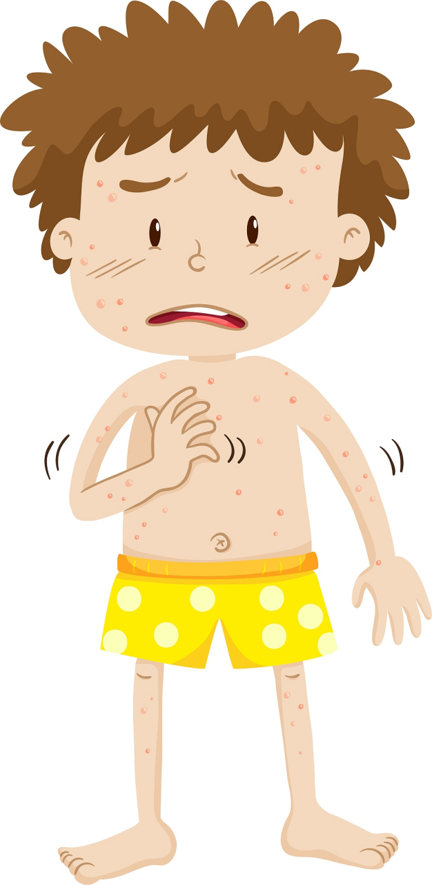 皮肤管理课堂#  #关注健康养生#  大多数情况下,得过一次水痘的人,不