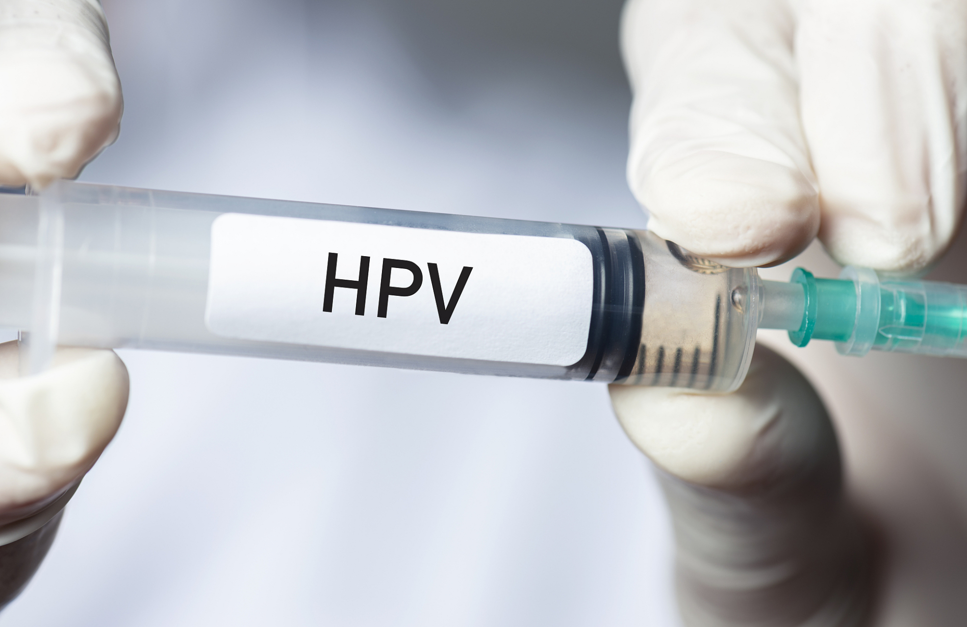 易感染hpv的三大因素,需及時警惕 人乳頭瘤病毒(hpv)感染通常在早期