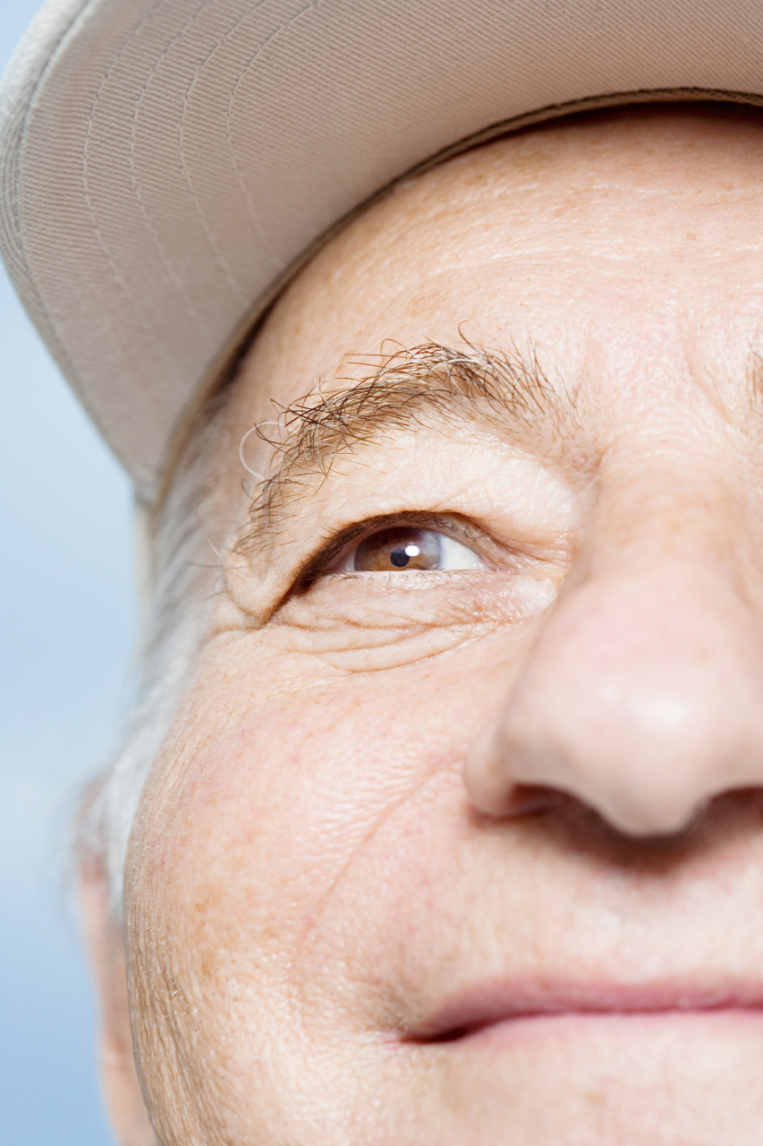 鼻翼纹和法令纹的区别  鼻翼纹和法令纹都是面部常见的皱纹,但它们