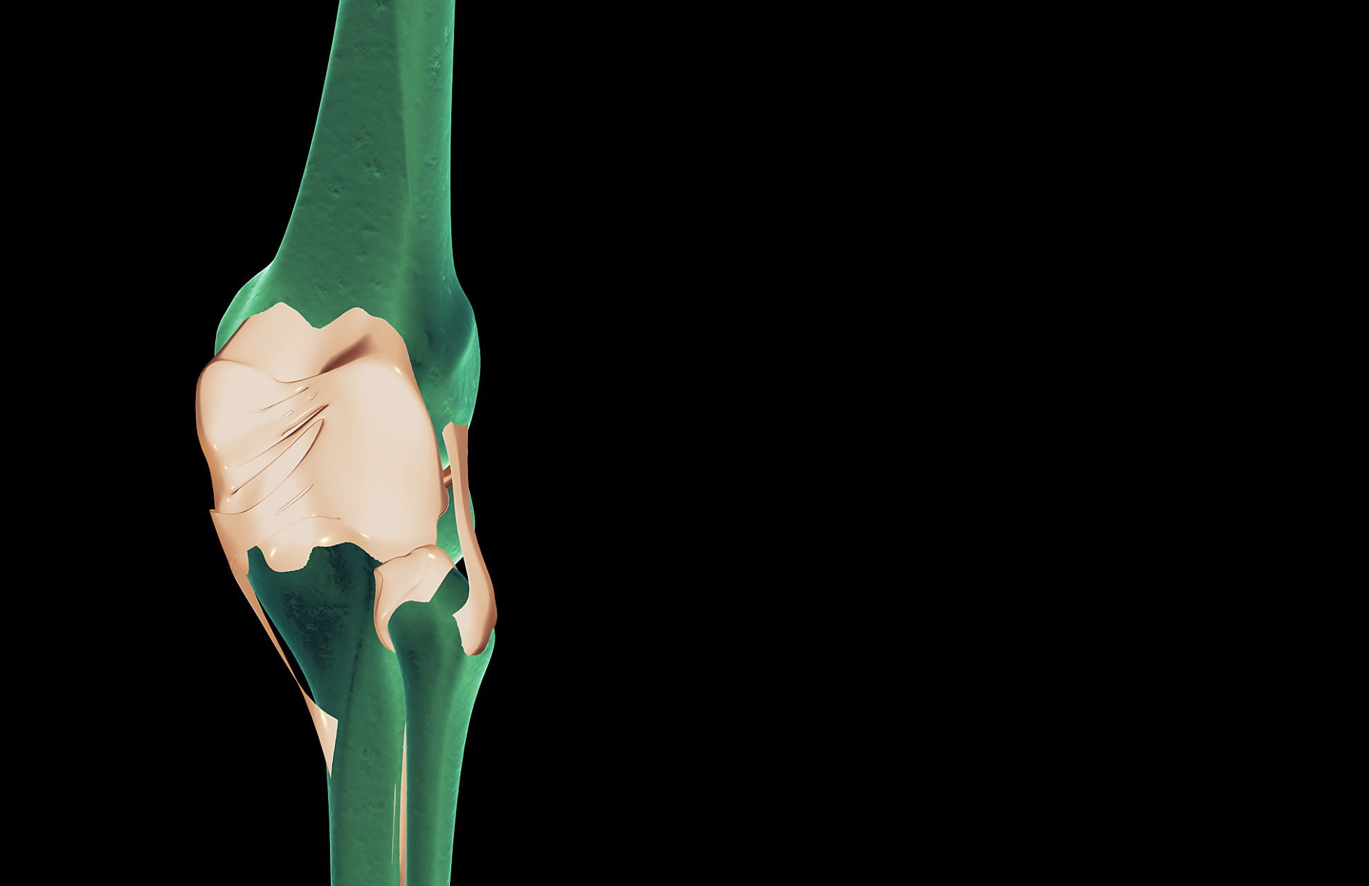 内侧副韧带手术后多久进行康复训练	内侧副韧带手术后通常3个月左右