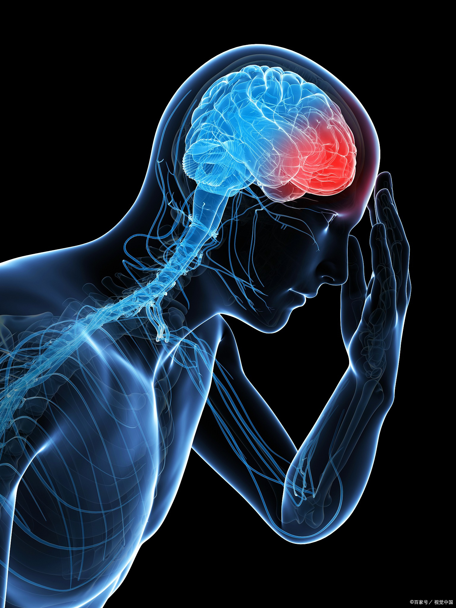 季节性头痛是什么原因?