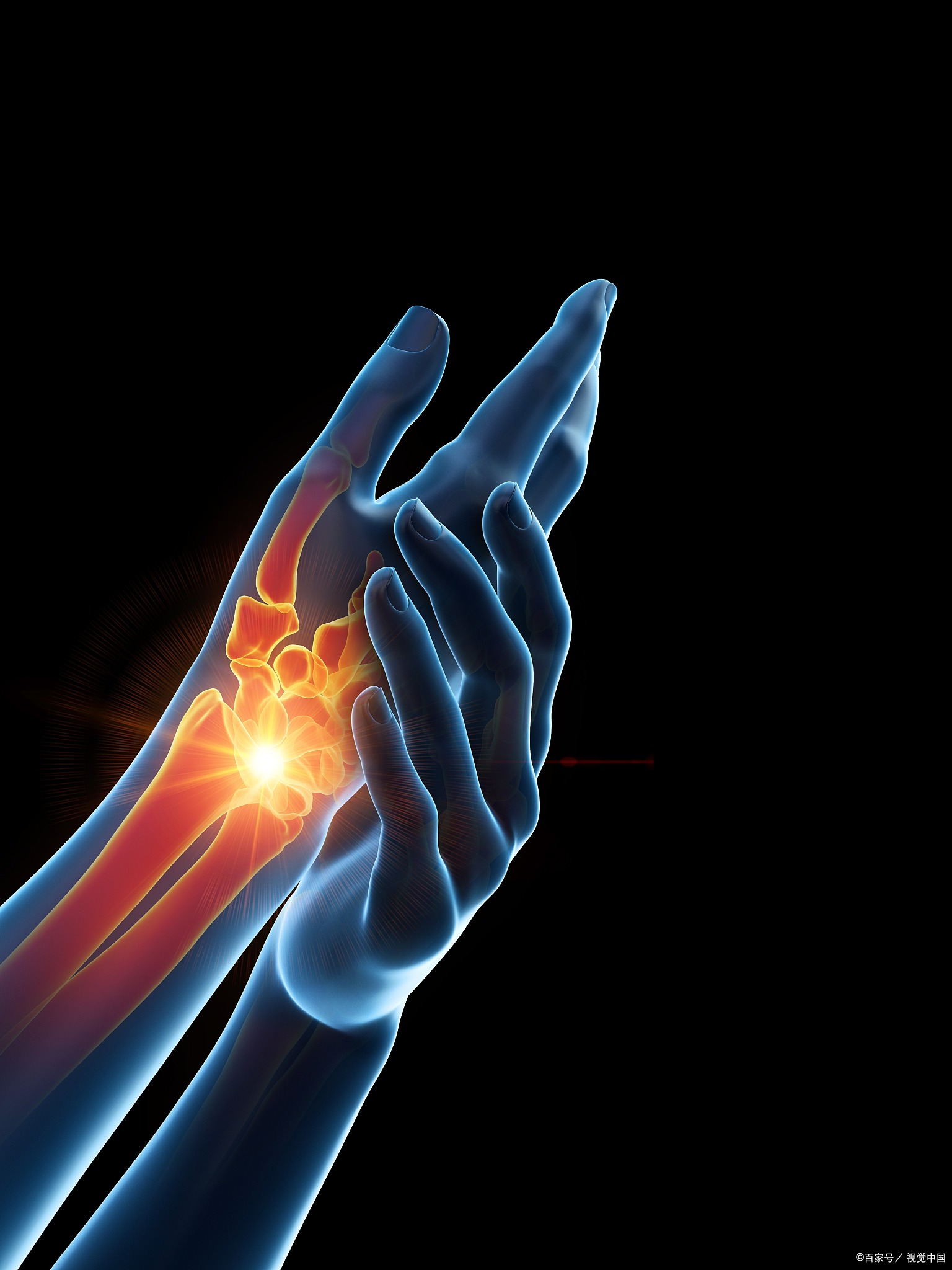 尺神经损伤后,患者往往会首先感受到手臂,手腕和手指的刺痛,麻木或