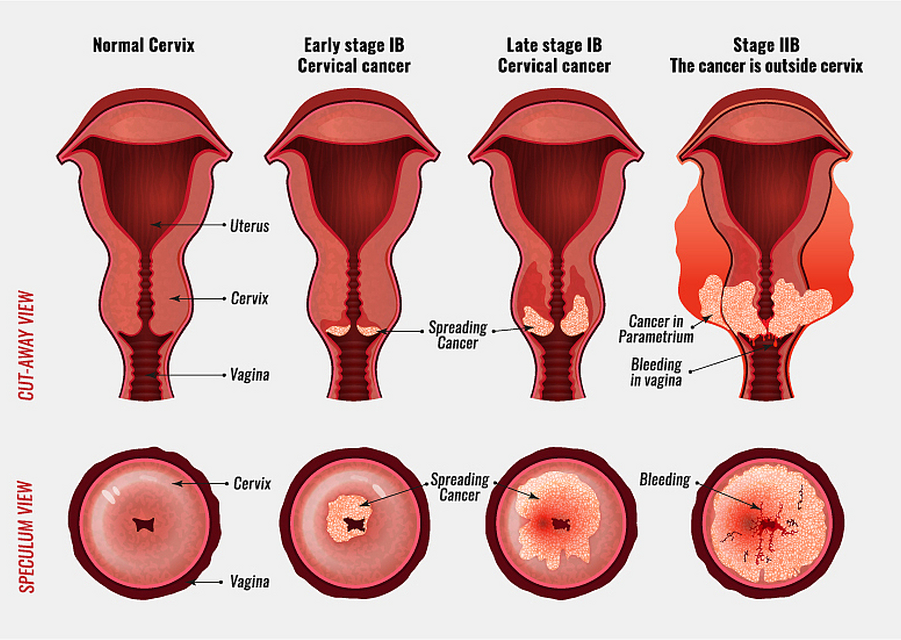 月经来潮前宫颈变化图图片