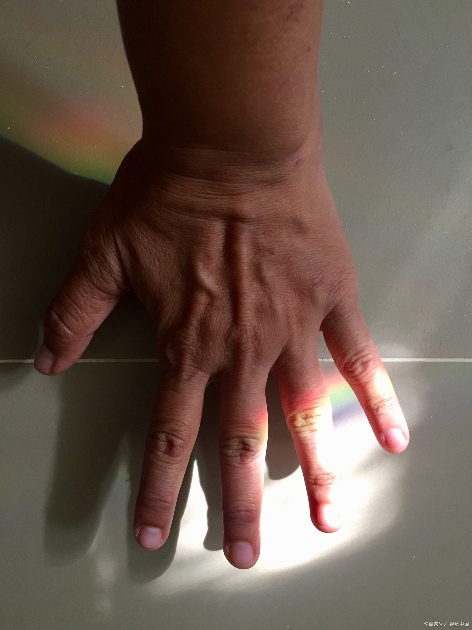 经常手指关节疼痛,要考虑关节劳损,骨性关节炎以及类风湿关节炎: