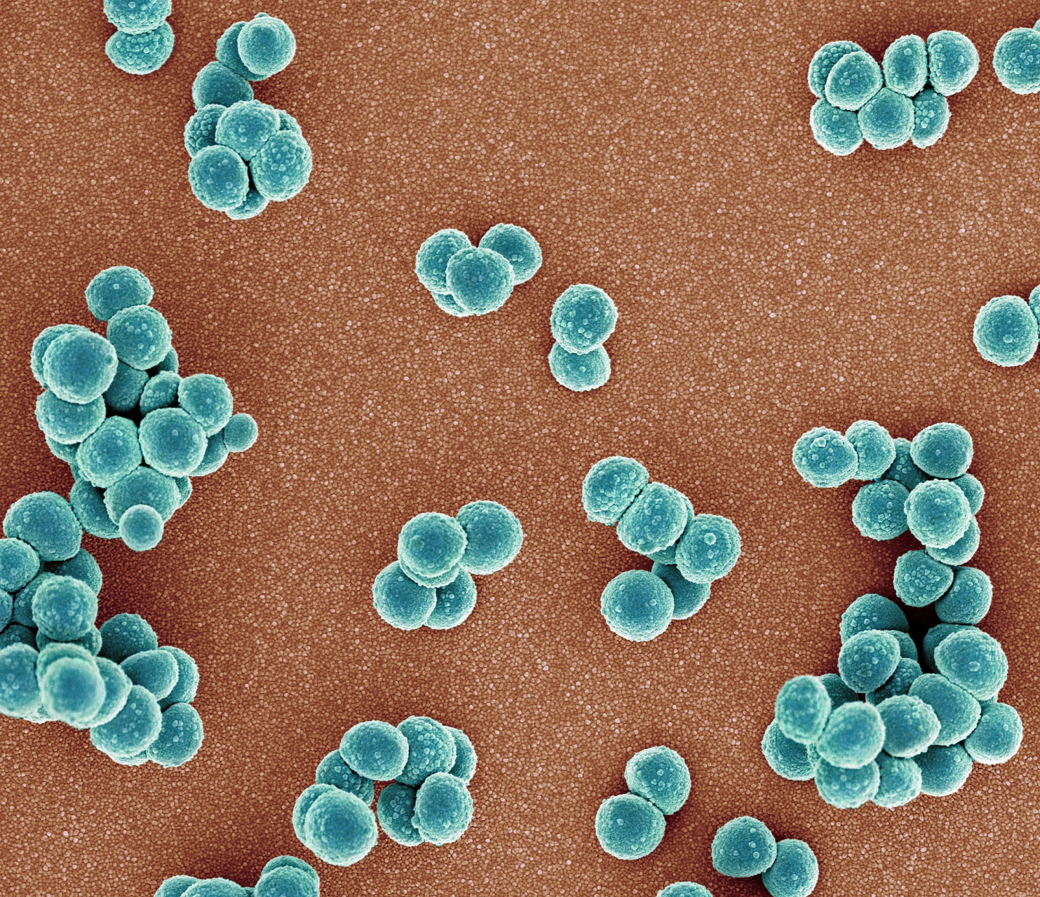 嗜热菌广泛分布在温泉等地,根据对温度的不同要求,嗜热菌可划分为以下