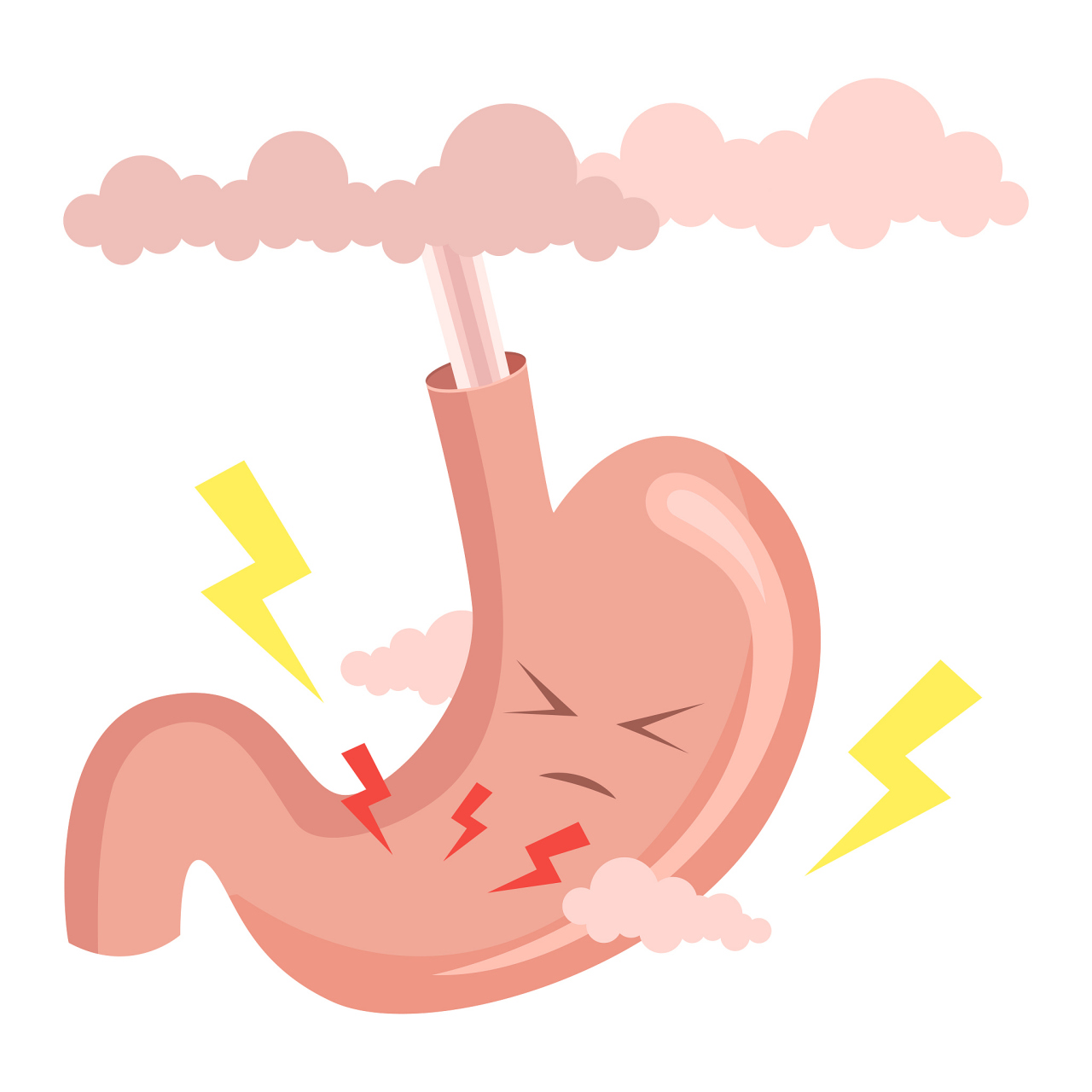 沈阳胃肠医院# #沈阳胃酸# 如何减少胃食管反流的发生?