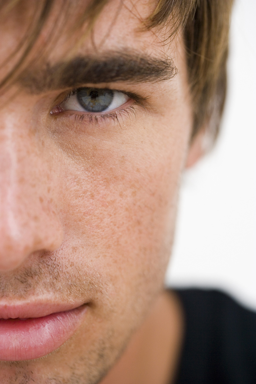 男生脸上有雀斑怎么去除?