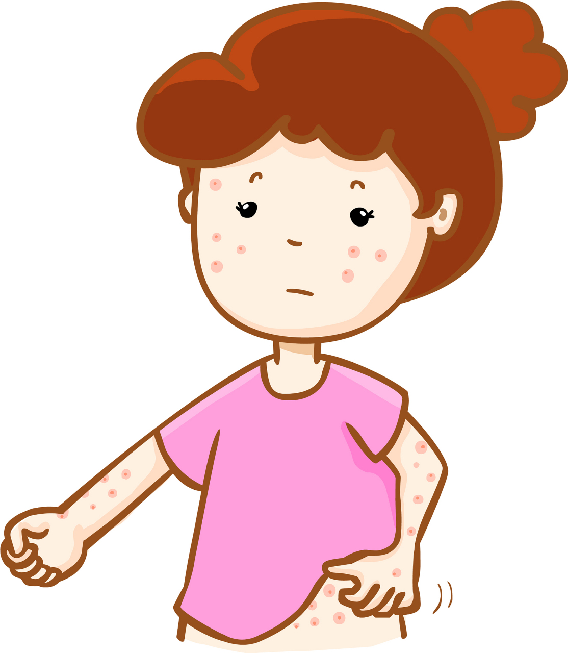 湿疹#   湿疹是一种皮肤病,它有很多种表现形式,比如红疹,瘙痒,皮肤