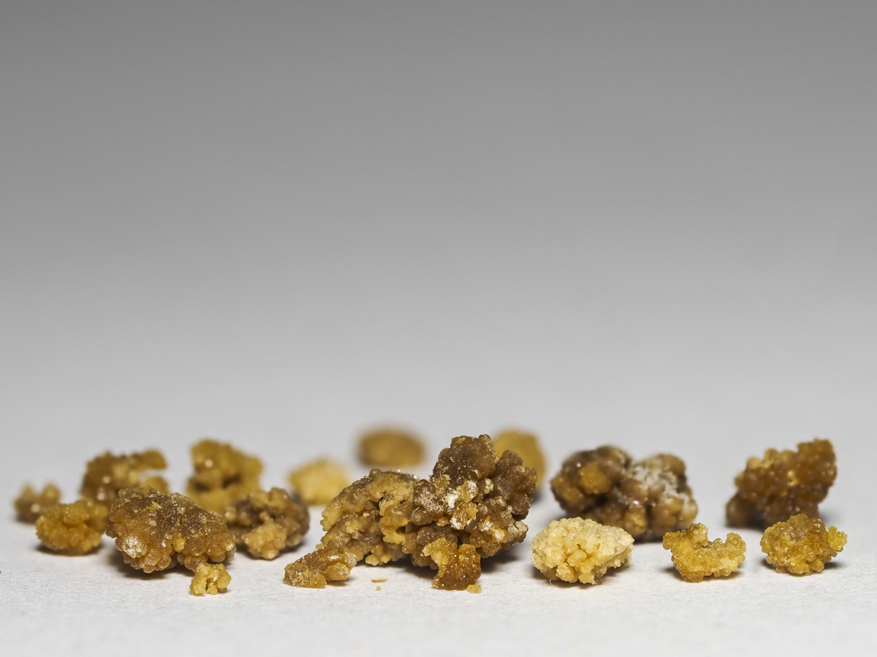 98经常遇到患者询问输尿管结石手术刀口的大小.