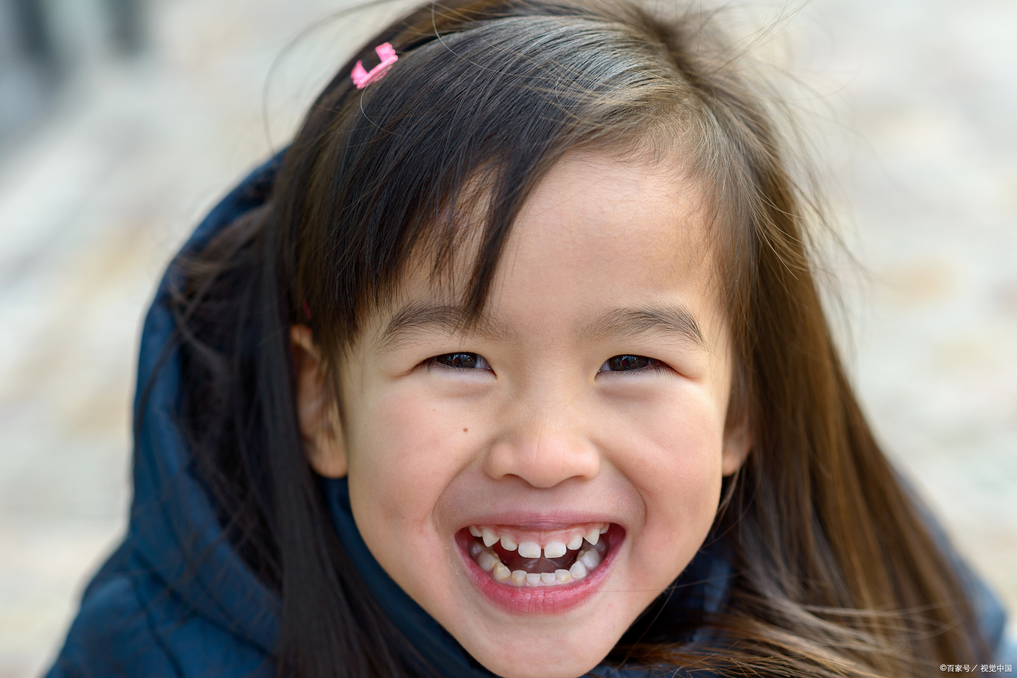 儿童的牙齿会遗传父母吗?