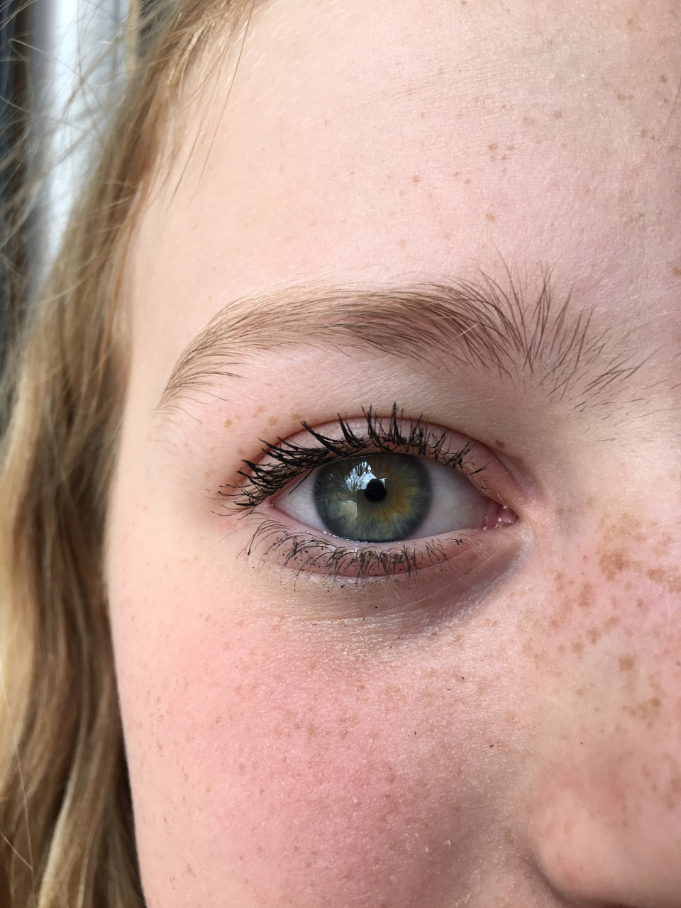 远离眼部泪斑的有效方法 #悦己爱眼季#  #激光祛斑#   泪斑是指出现在