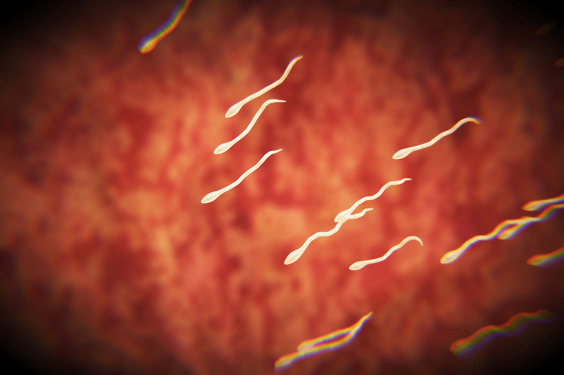 1,感染炎症:这是血精的最常见原因,以精囊炎为多见.