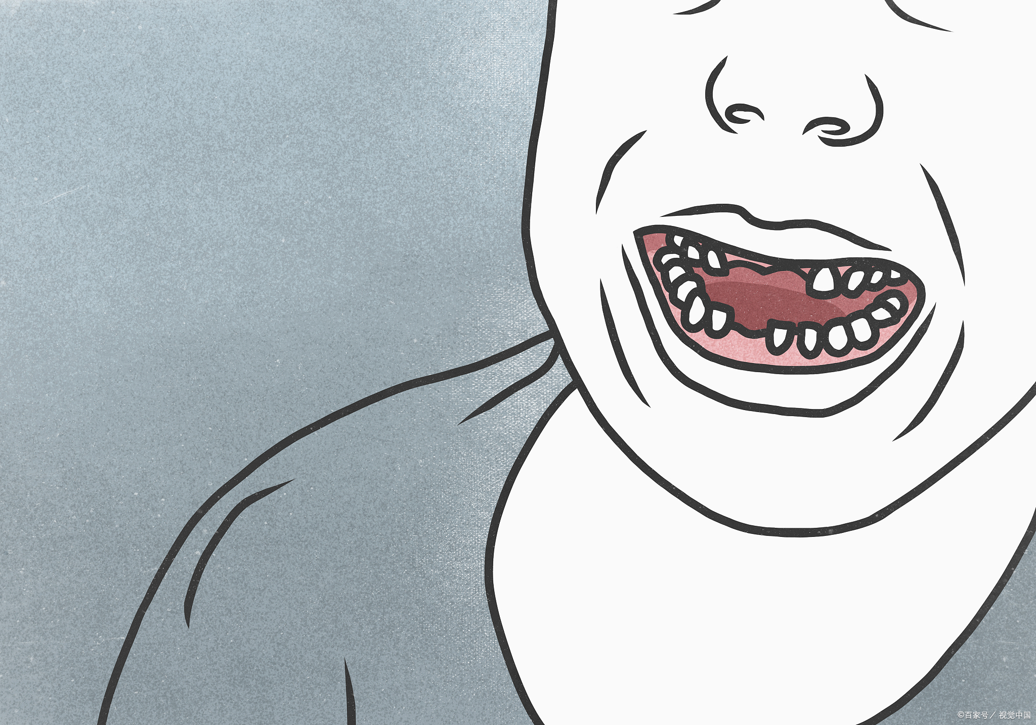 全口缺牙不仅影响咀嚼功能,更关乎生活质量