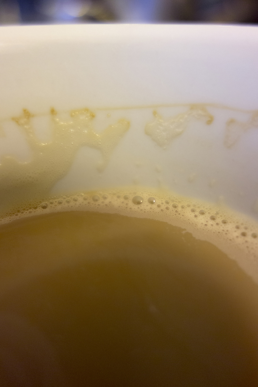 尿液有泡沫是什么原因? 尿液出现泡沫可能是由多种原因引起的.