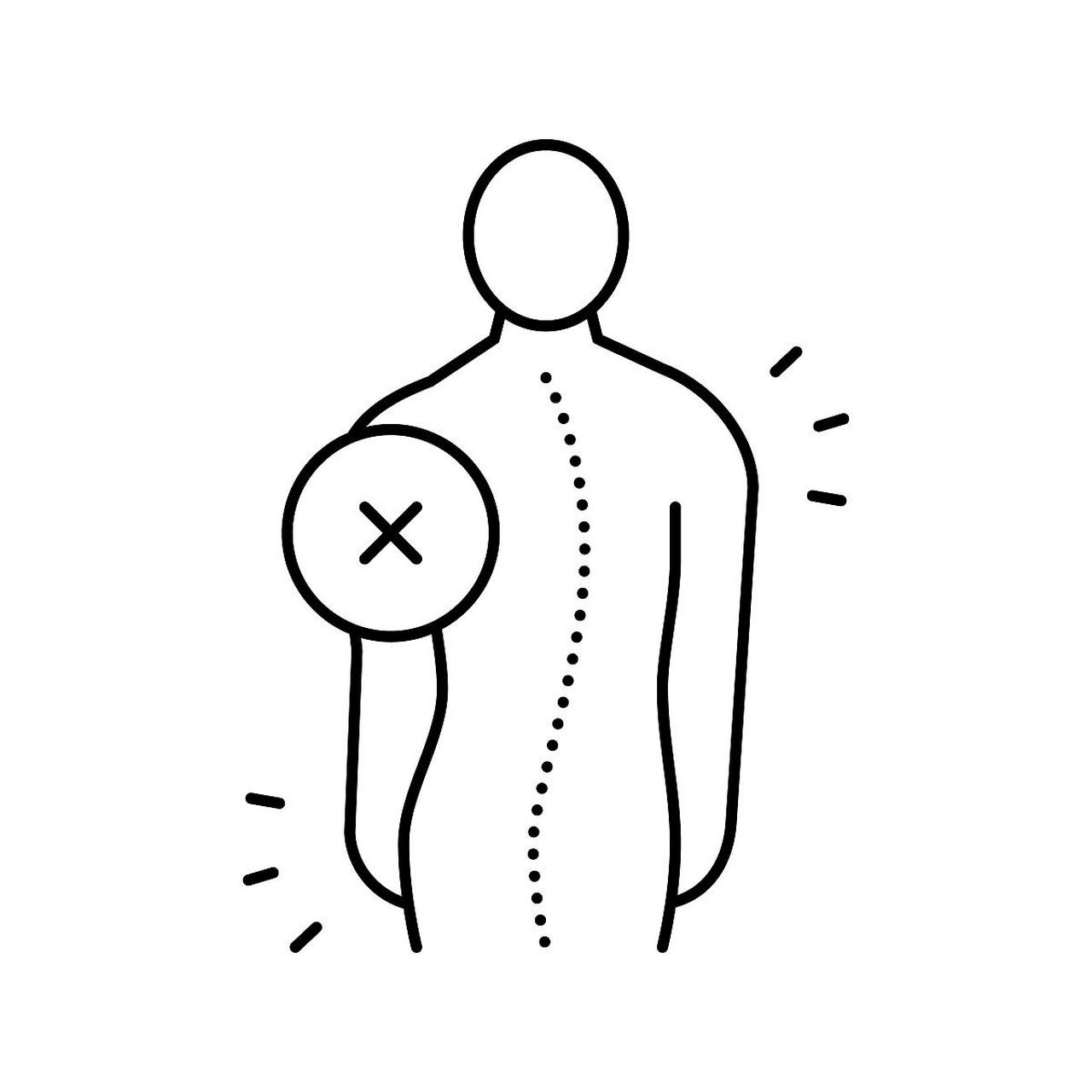 当患者发生了脊柱侧弯时,有下列情况,需要考虑进行手术矫正,第一,胸弯