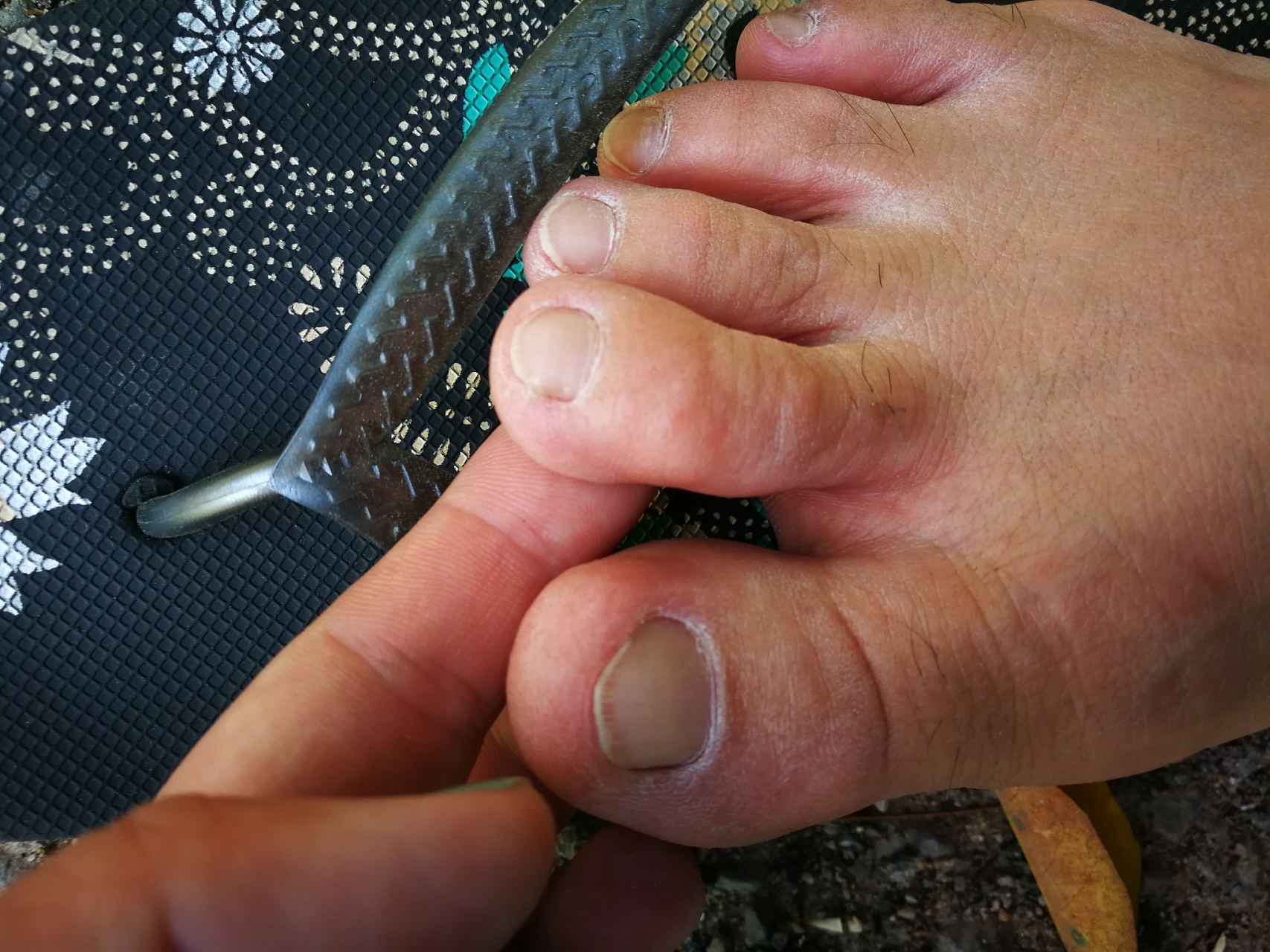 晚上脚趾头一阵一阵疼可能是痛风性关节炎,骨关节炎等原因引起的,可以