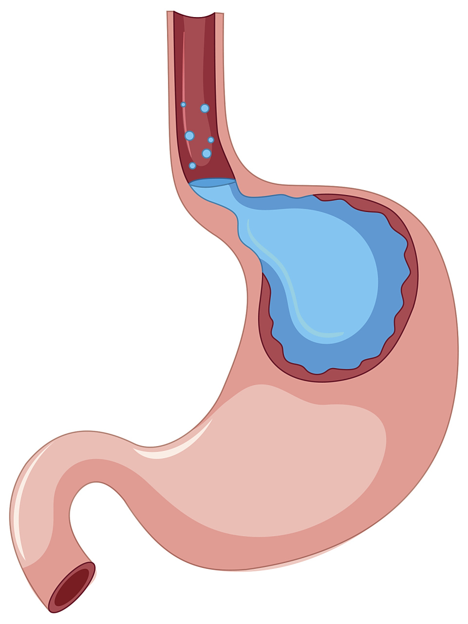 11566不良的生活习惯是重要诱因.