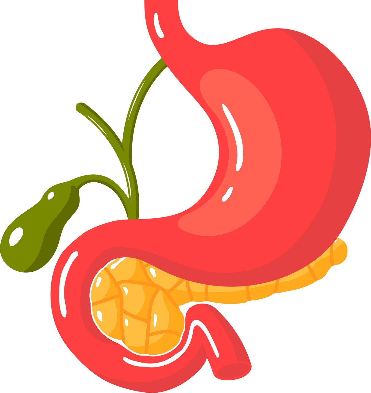 胰腺切除一半,影响寿命吗?