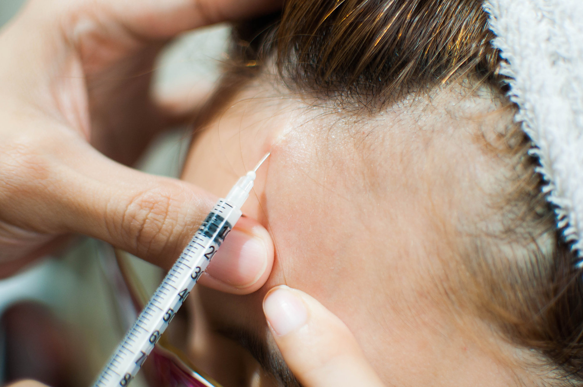 疤痕疙瘩软化针是不是智商税? #疤痕疙瘩# 痕疙瘩打针治疗靠谱吗?