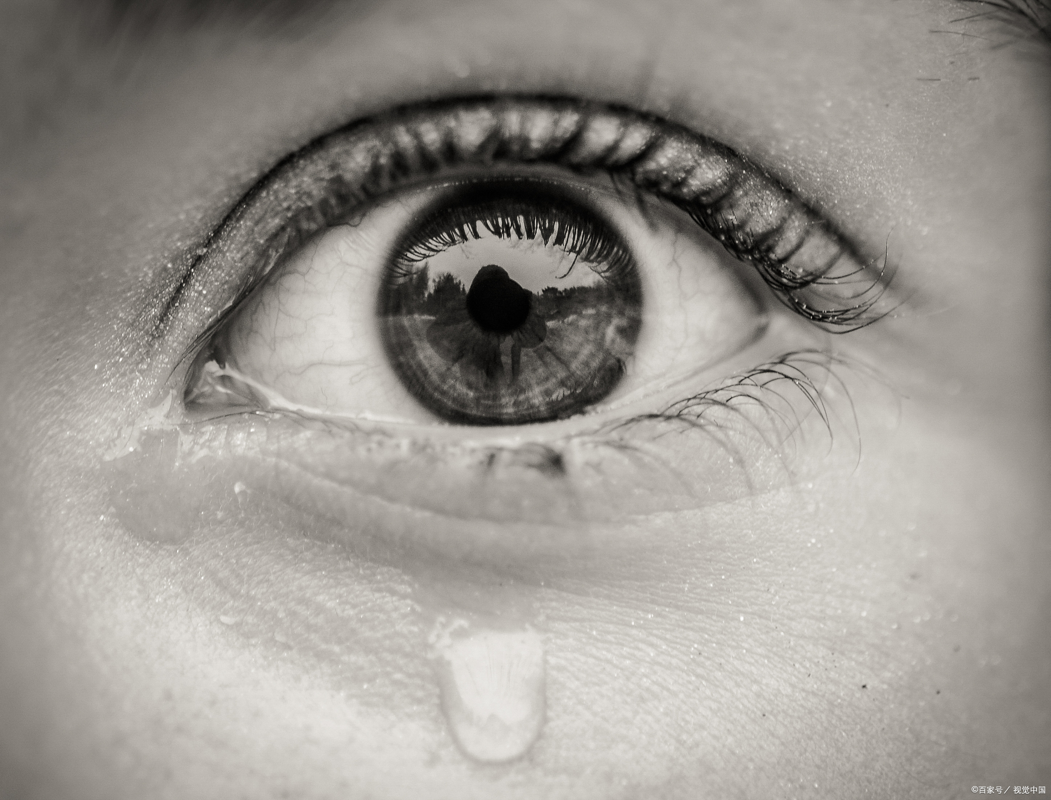 这可能就是溢泪症在作祟